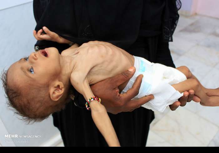 یمن، کشور مادران بی پناهی که هر 10دقیقه داغدار کودکی گرسنه می شوند!/ رقابت خمپاره ها و موشک های سعودی در گرفتن جان کودکان یمنی