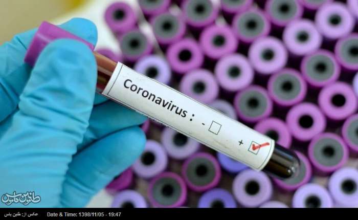 واکسن ویروس کرونا تا ۳ ماه آینده آماده می‌شود