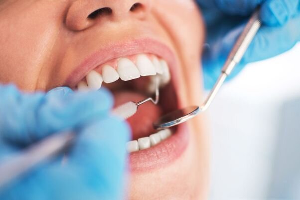 ۵ عادت نادرست که دندان‌هایتان را خراب می‌کند | پاستیل نخورید