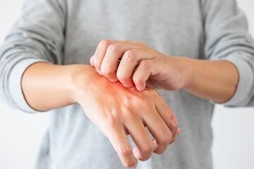 تاثیر میکروبیوم روده بر سلامت پوست