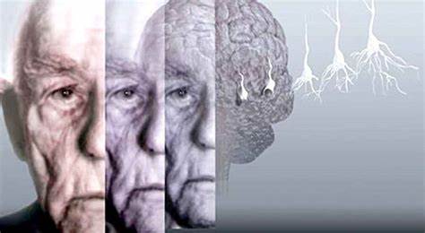 دارویی آشنا که خطر زوال عقل را ۱۳ درصد کاهش می‌دهد