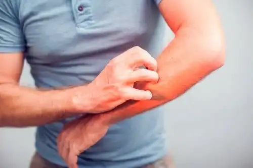 سلیاک؛ بیماری هزار چهره