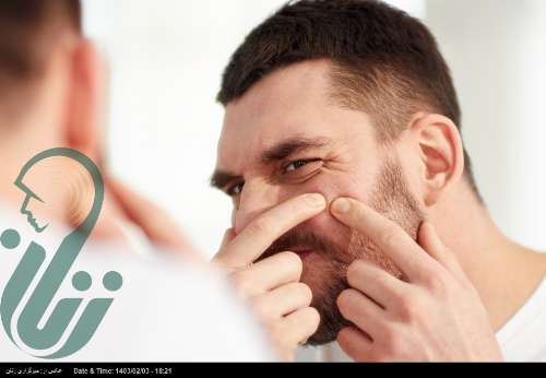 ۱۰ راهکار مؤثر برای از بین بردن جوش‌های صورت