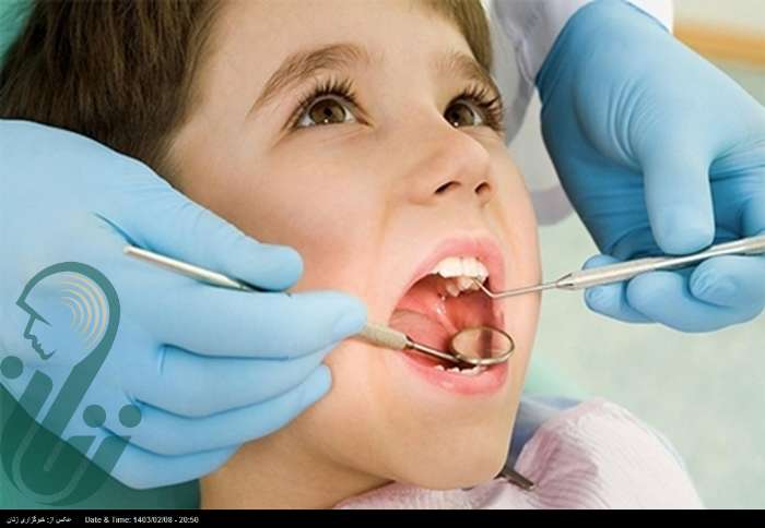 برنامه وزارت بهداشت برای سلامت دهان و دندان