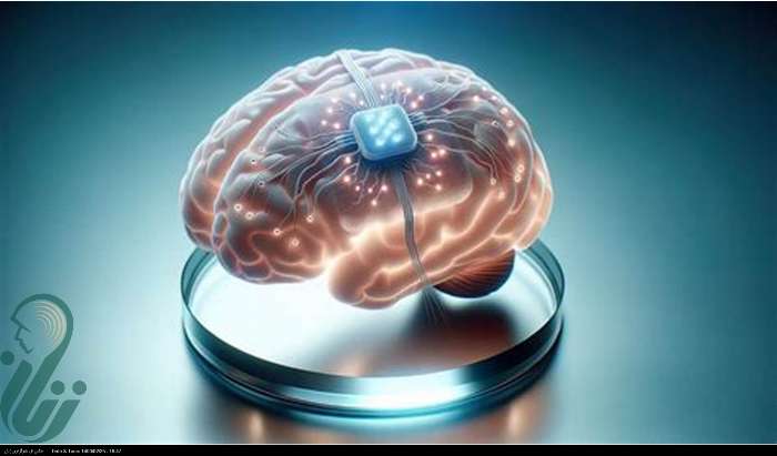 این ایمپلنت مغزی جدید می‌تواند ذهن را بخواند!