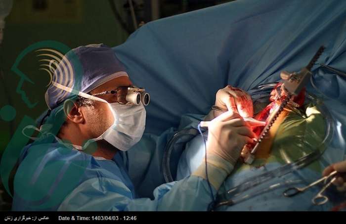 عوارض شدید و غیرقابل جبران جراحی های زیبایی توسط نامتخصصان