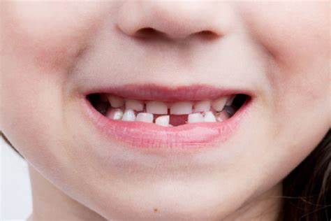 قطره آهن دندان کودک را سیاه می‌کند؛ فریب تبلیغات را نخورید