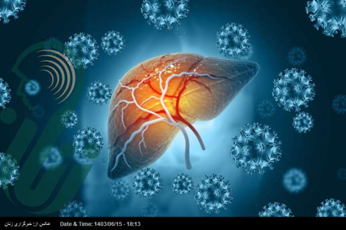 با ترک این ۵ عادت از ابتلا به سرطان کبد جلوگیری کنید
