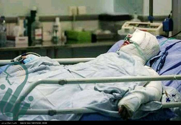 ۳۸ هزار نفر در سال ۱۴۰۳ دچار سوختگی شدند