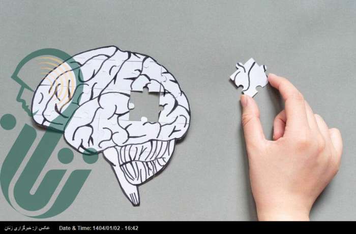این بیماری مغزی را با آلزایمر اشتباه نگیرید