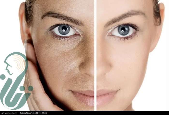 چهار مرحله برای مراقبت از پوست