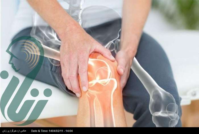بهبود قابل توجه درد زانو با داروی دیابت!