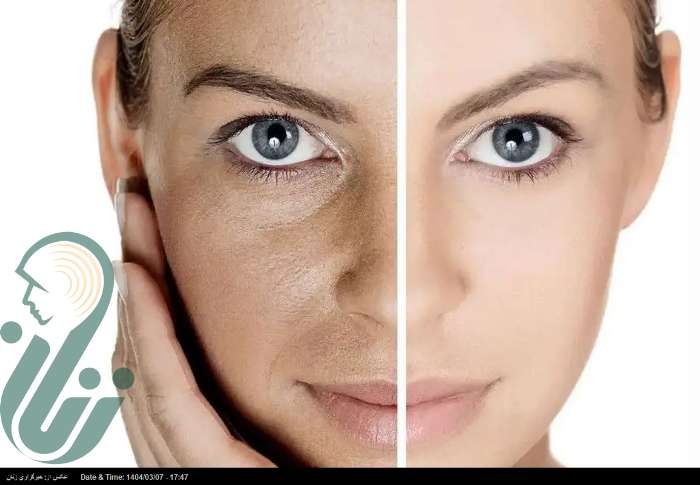 فوت و فن زیبایی؛ چهار مرحله برای مراقبت از پوست
