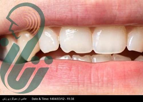 خوردن تخمه باعث فاصله افتادن بین دندان‌ها می‌شود؟