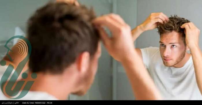 چطور با چند خوراکی ساده از موها مراقبت کنیم؟