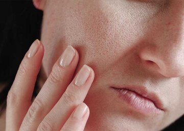 تغذیه مناسب برای حفظ سلامت کلیه‌ها