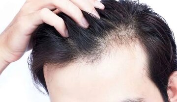 با چند خوراکی ساده از موها مراقبت کنیم