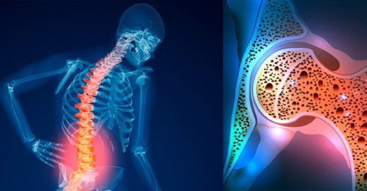 این بیماری از دهه چهارم زندگی شروع می‌شود