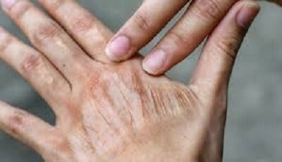 اشتباه‌های رایج در مراقبت روزانه از پوست