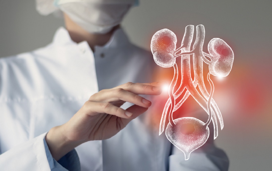 تأثیر شگفت انگیز دارو‌های کاهش وزن برای بیماران نارسایی کلیه