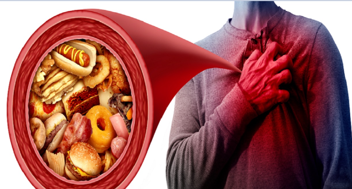 یافته‌های غیرمنتظره در مورد تأثیر چربی اشباع بر سلامت قلب