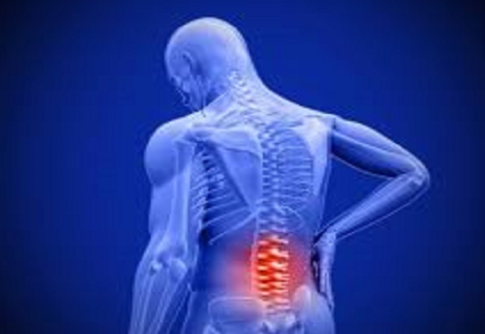 ۵ روش مؤثر در درمان کمردرد